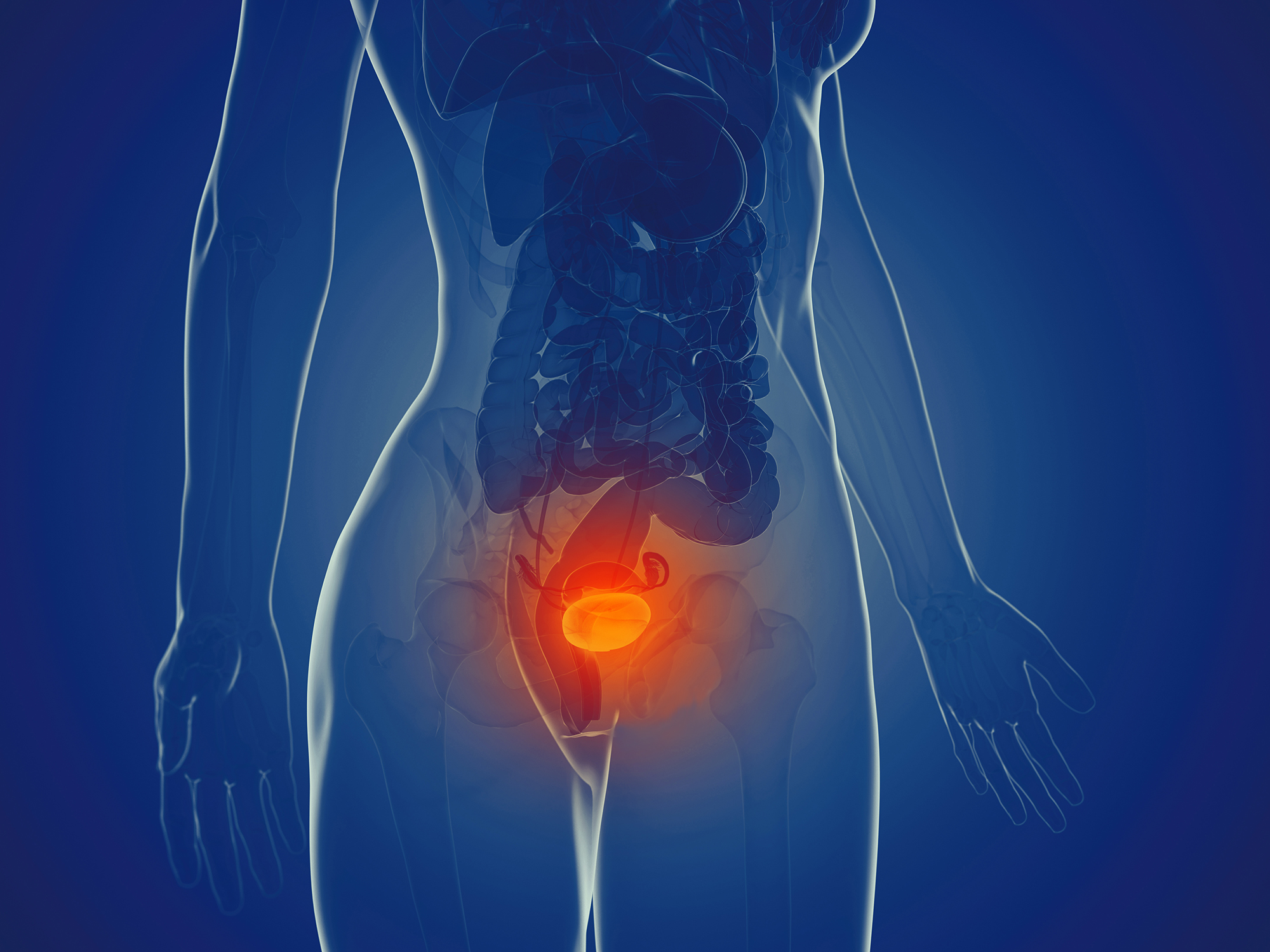 Major Cause of Urinary Tract Infection