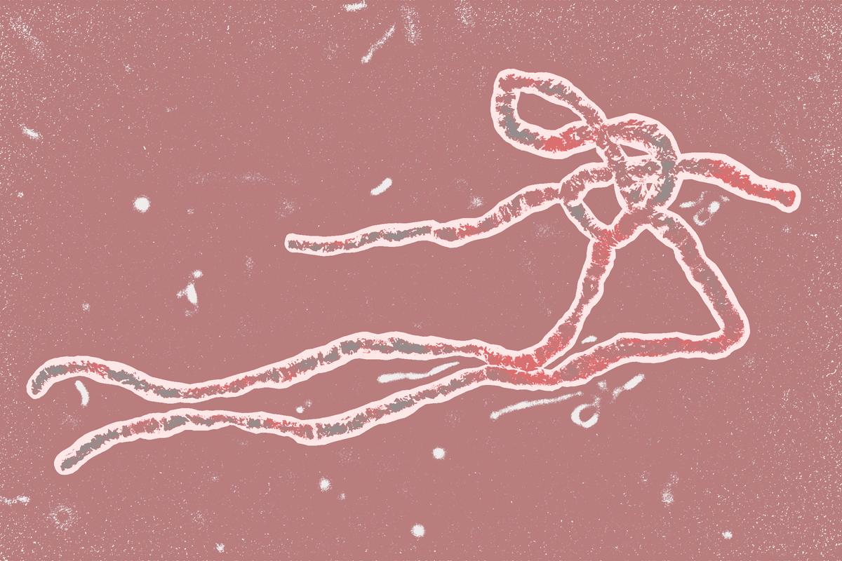 Ebola Virus Is Deadly, but Here’s Why You Don’t Need to Worry