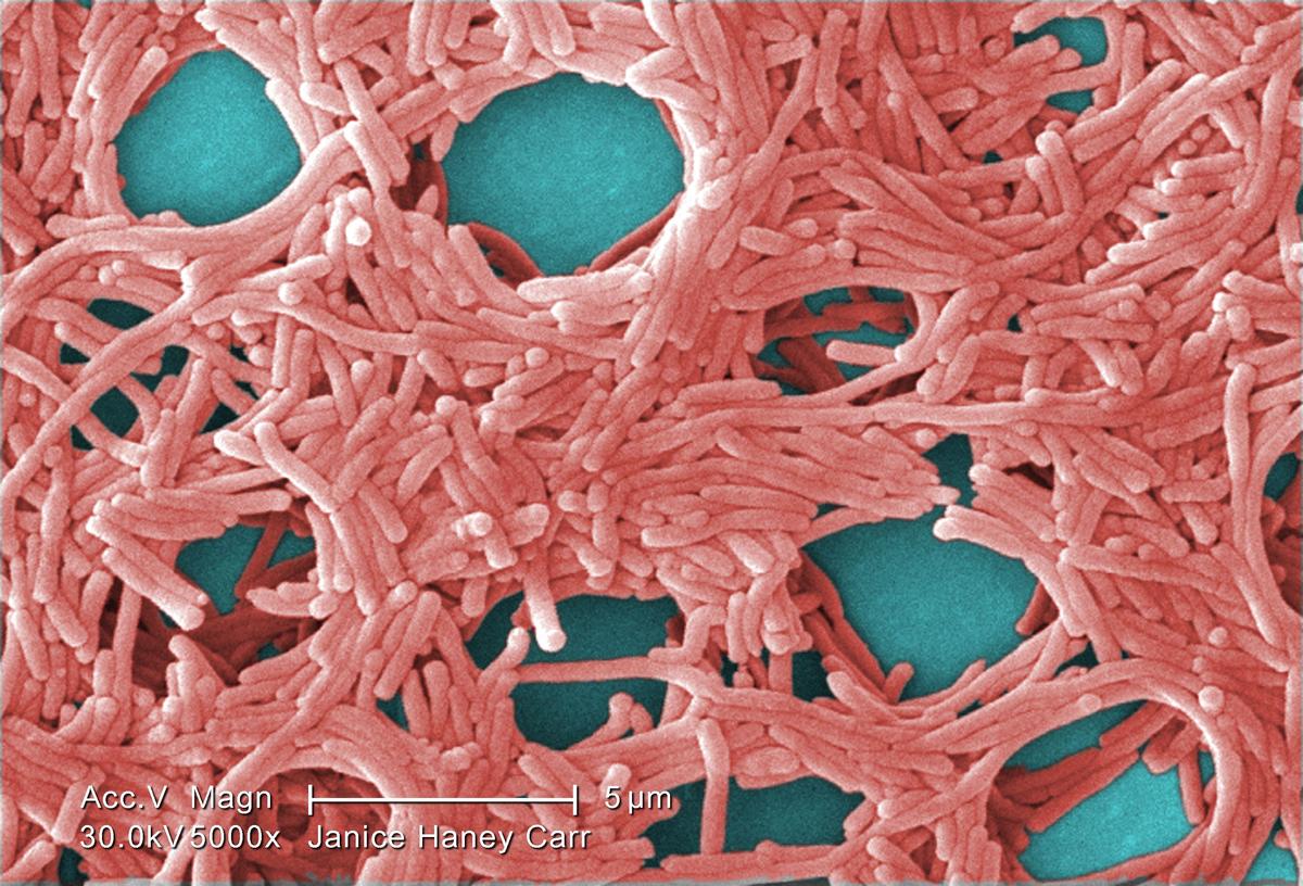 New York Launches Investigation Into Legionnaires’ Disease Community Cluster