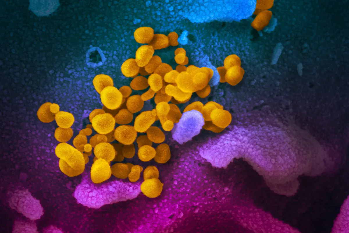 New COVID-19 Variant Found in 25 US States, Says CDC