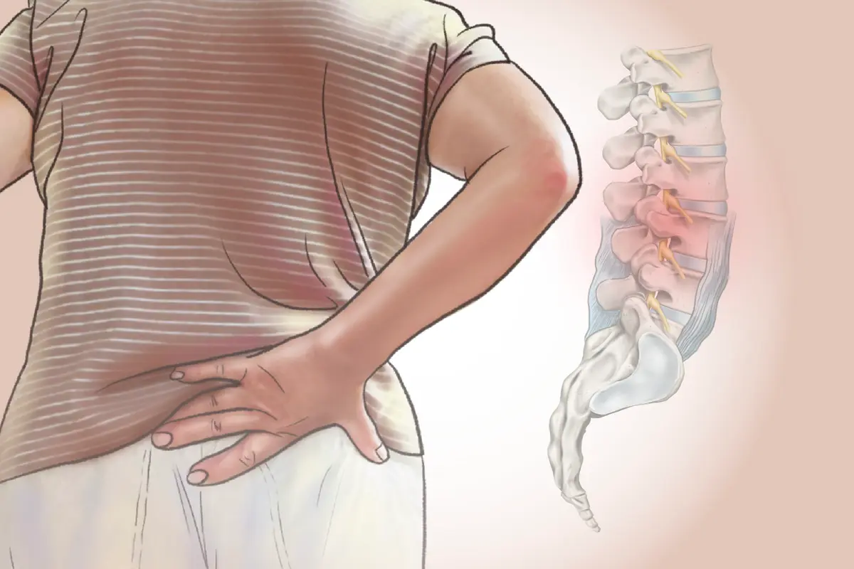 Lower Back Pain: The Most Common Musculoskeletal Condition–Here Are the Causes thumbnail