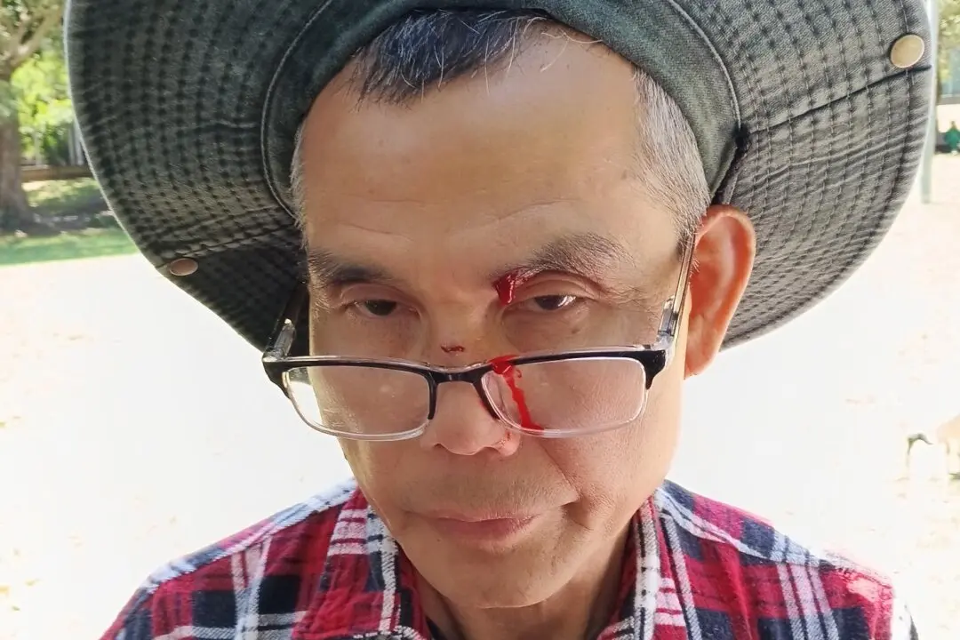 Assault Leaves Falun Gong Practitioner Bloodied, Days After Bomb Threat