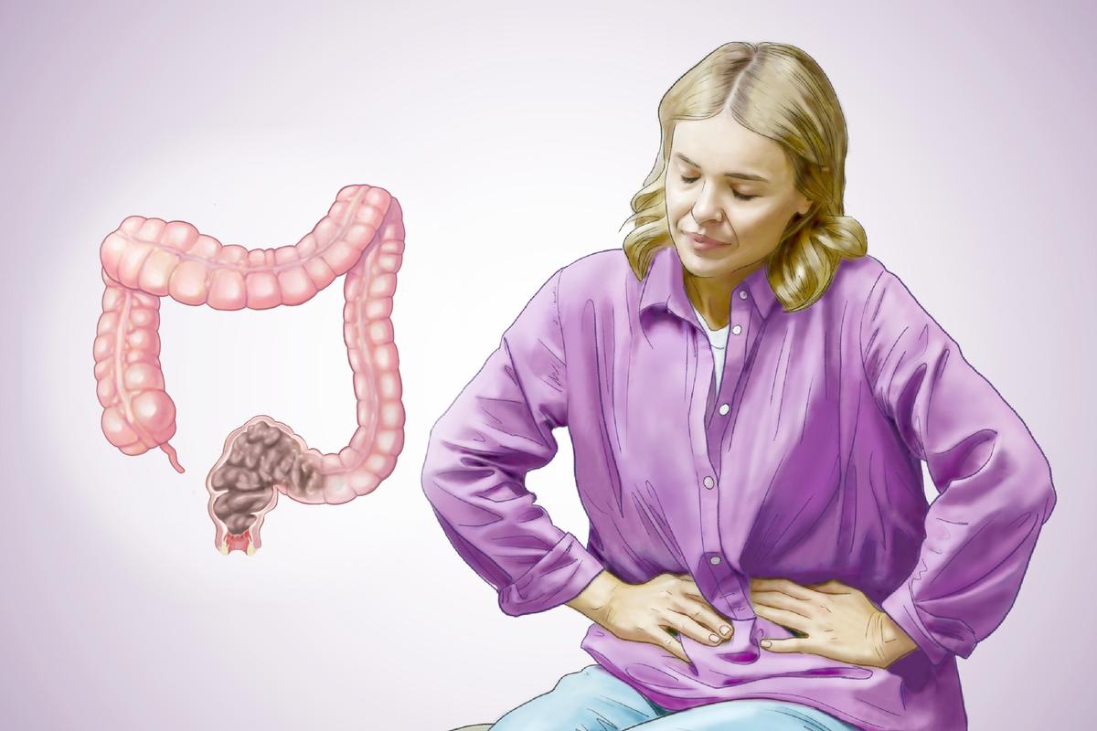 Constipation: Nearly Everyone Has It at Some Point, Why and How to Relieve It thumbnail