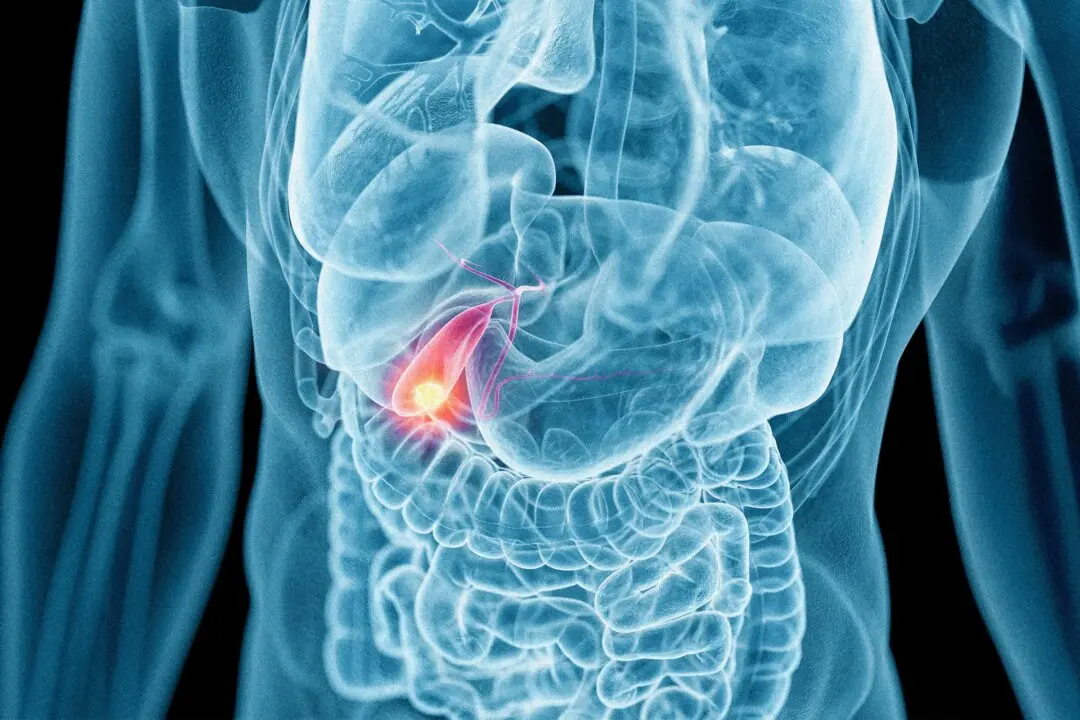 Is Gallbladder Removal Always Necessary? What Patients Should Know
