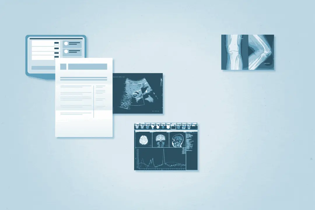 How a Medical Second Brain is Key To Your Treatment