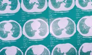 This Aggressive Lung Cancer Often Hides Until It’s Too Late