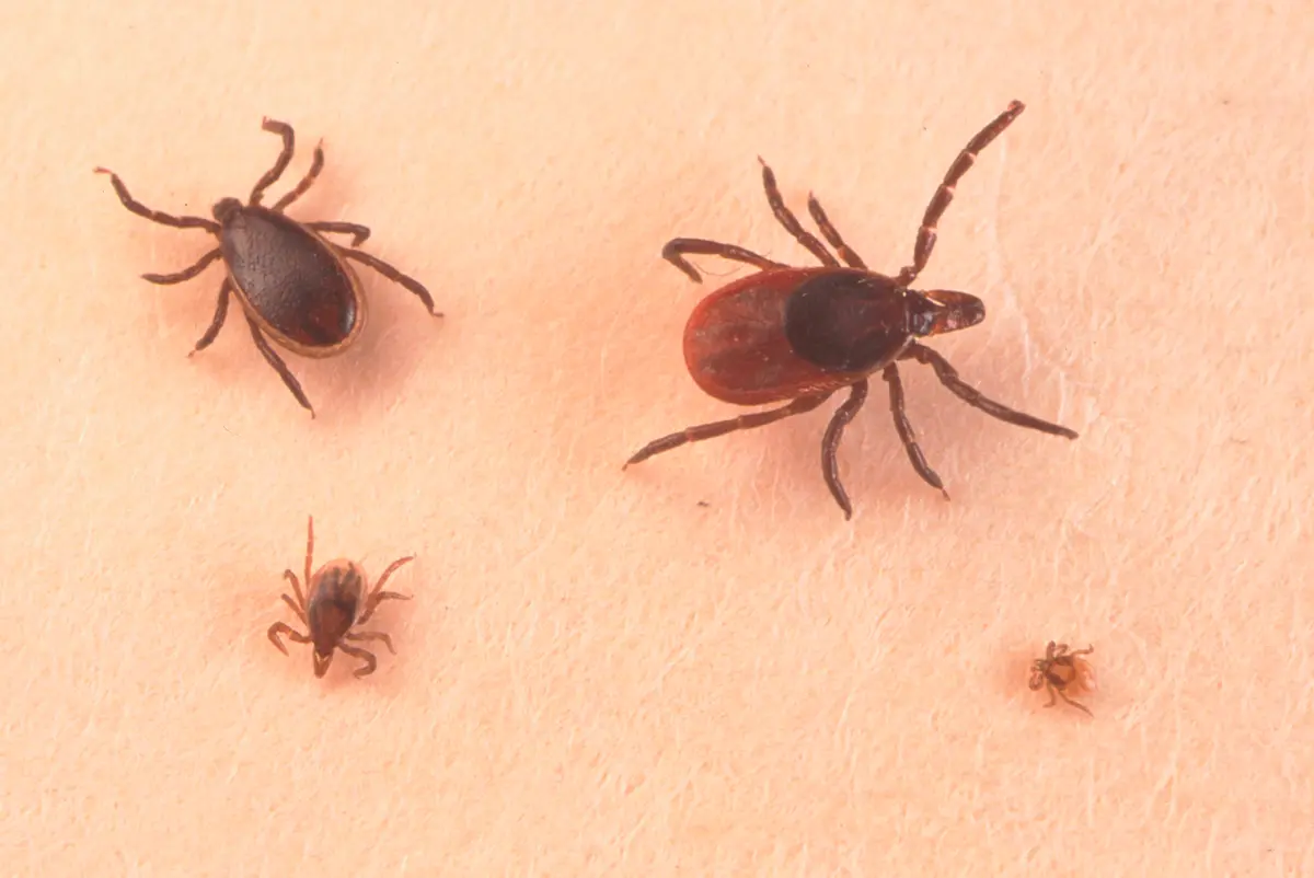 CDC Issues Warning on Tick Bites, Lyme Disease