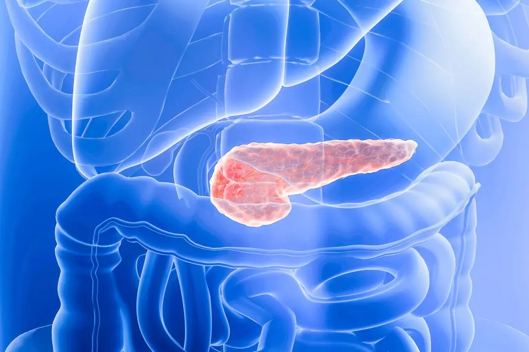 New Drug Extends Survival for Patients With Pancreatic Cancer