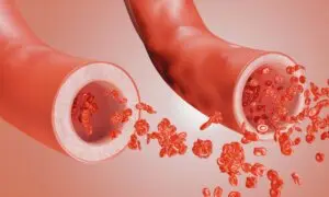 Your Scrolling Habit Could Be Raising Your Blood Pressure