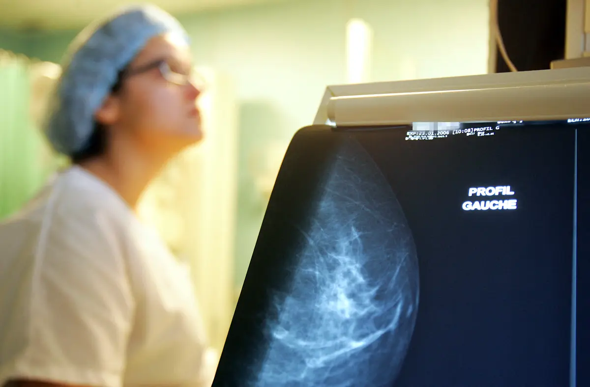 Doctor Group Updates Guidance on Breast Cancer Screening