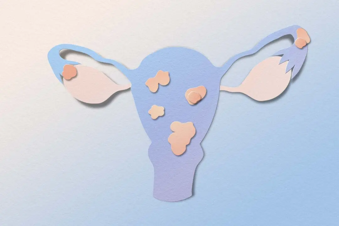 New Noninvasive Imaging Could Cut Years Off Endometriosis Diagnosis