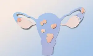 New Noninvasive Imaging Could Cut Years Off Endometriosis Diagnosis