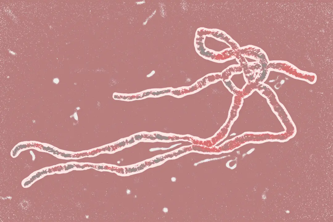 Ebola Virus Is Deadly, but Here’s Why You Don’t Need to Worry