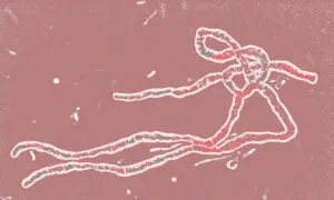 Yes, Ebola Virus Is Deadly. But Here’s Why You Don’t Need to Worry.