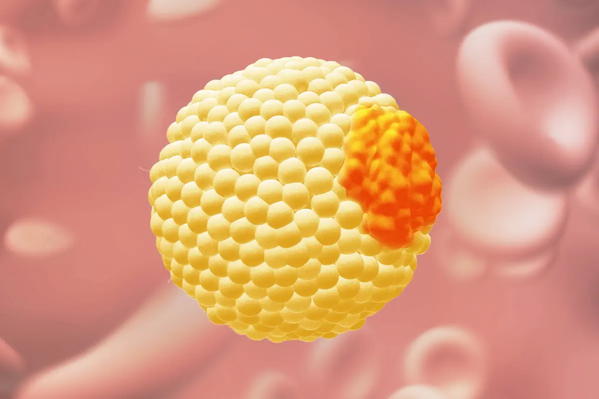 Why ApoB Is Sometimes a Better Test Than Cholesterol