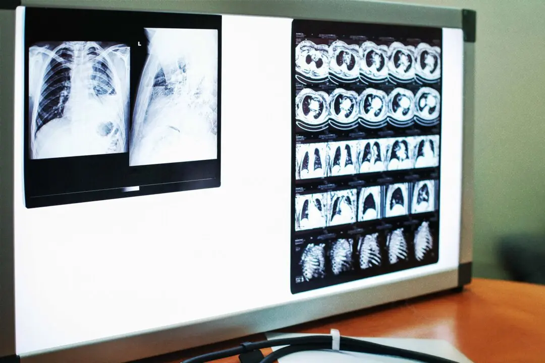 How One Man Defied Deadly Lung Cancer for More Than 7 Years
