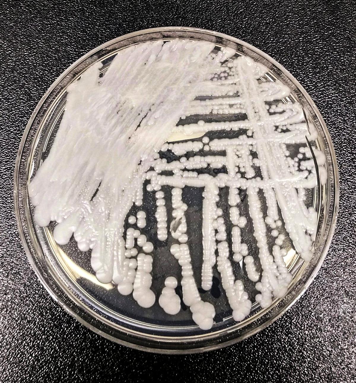 Cases of Potentially Deadly Fungus Detected in 27 States So Far This Year, CDC Says