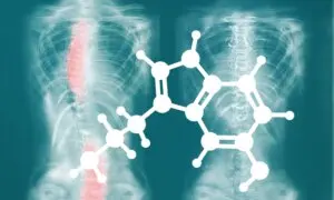 The Serotonin–Melatonin Connection to Scoliosis