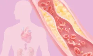 CKM Syndrome: A New Condition 9 in 10 Adults May Have–Here Are the Causes